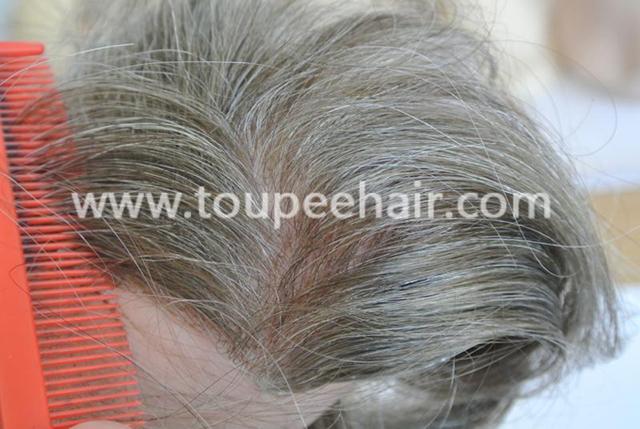 Invisible closure frontal
